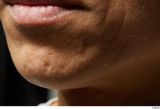 HD Face skin references Chikanari Ryosei lips mouth scar skin…